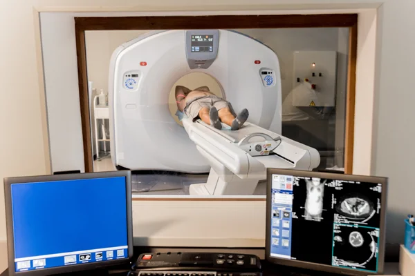 Stereotactic Radiosurgery